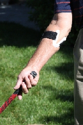 smärtlindring tennis armbåge musarm golfarmbåge!