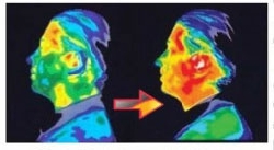 EMF skydd inlägg mobilen